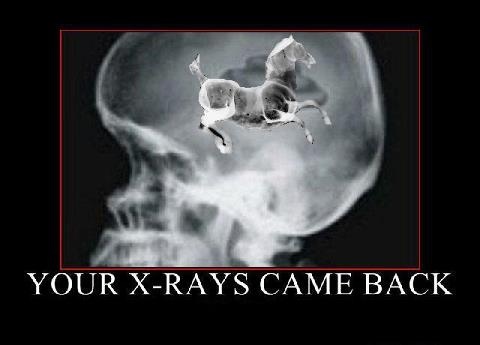 X-ray